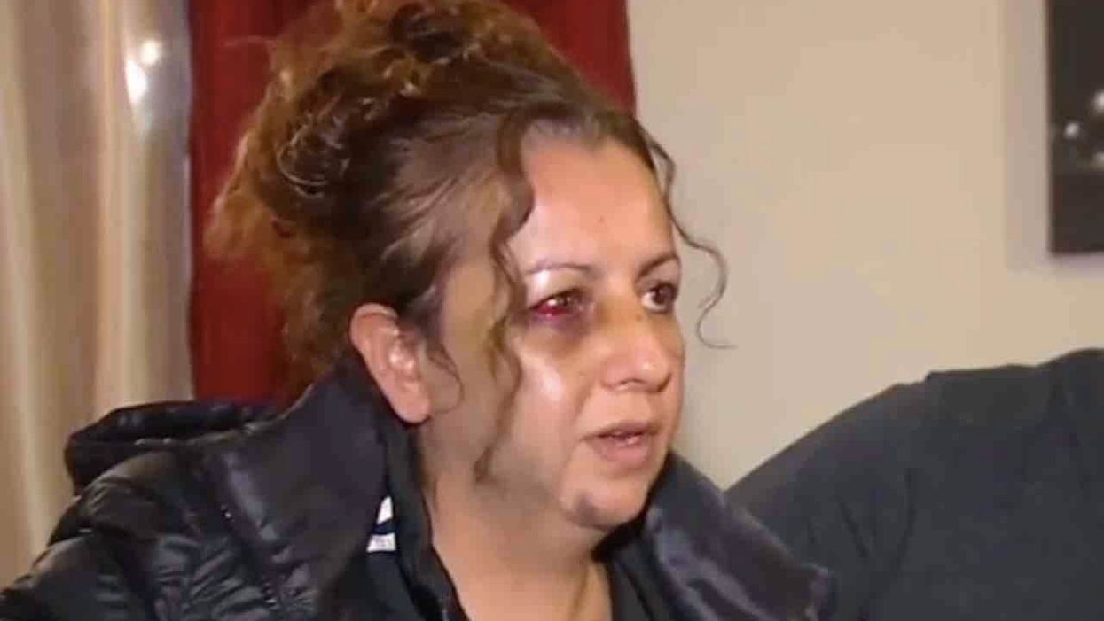 Mom beaten to a pulp by teen girls outside HS. She was there to complain about daughter's bullies — one of whom allegedly was part of the attack.