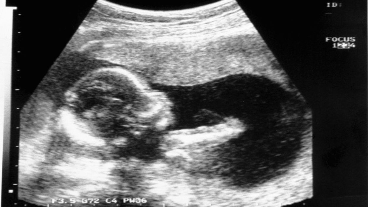 New medical research finding unborn babies may feel pain as early as 13 weeks could have significant implications