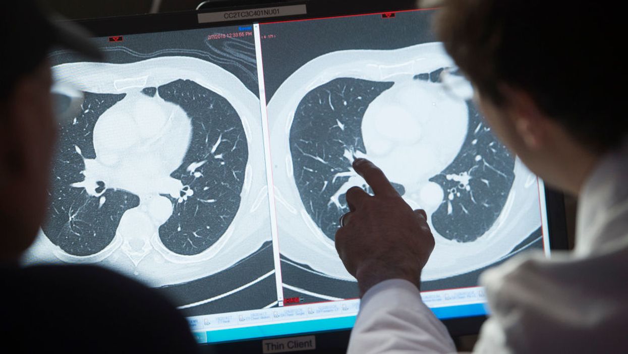 British scientists accidentally discover immune cell that 'may kill all cancer'