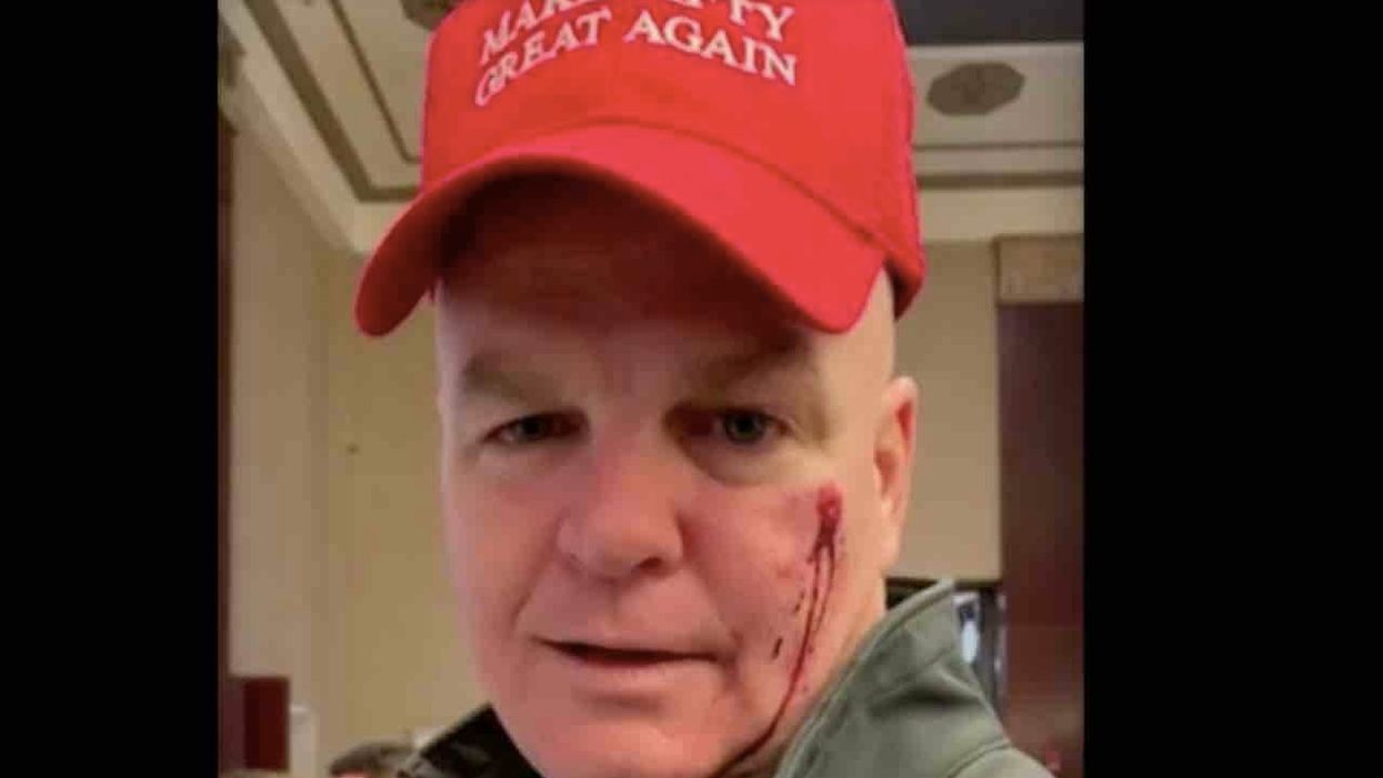 Retired NYPD officer says woman punched him in face, left it bloody on his birthday over red cap that looks like MAGA hat