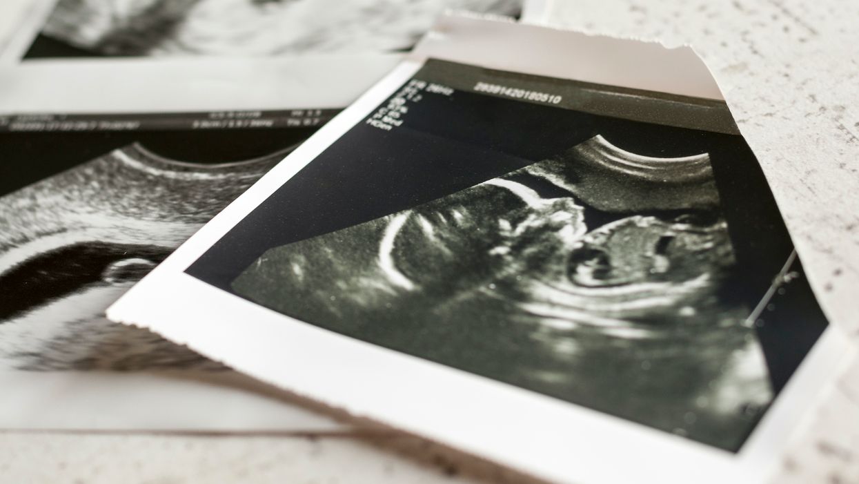 Florida legislature passes law to require parental consent for minors' abortions