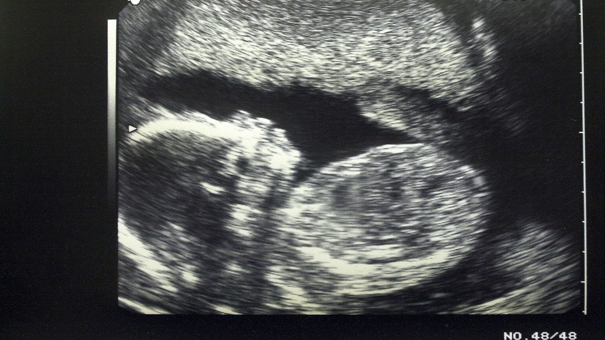 Female state senators from both parties walk out of chamber as Utah Senate passes pro-life ultrasound bill