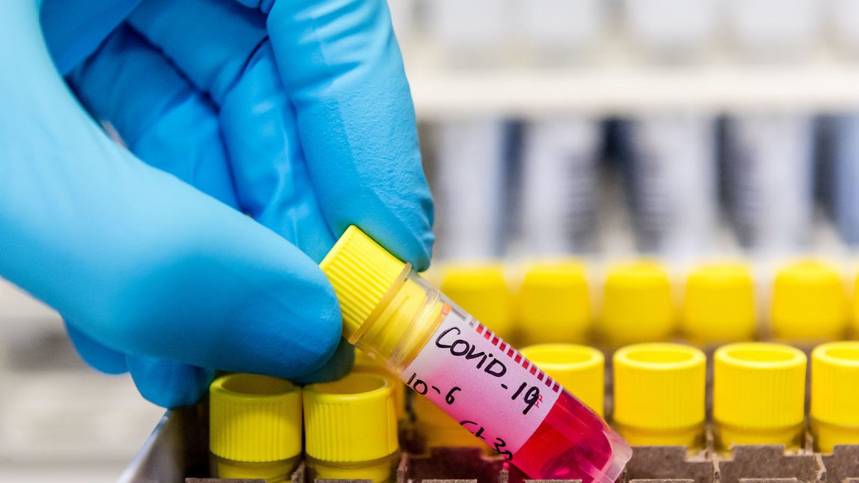 Study finds most coronavirus transmission comes from people who don’t know they have it