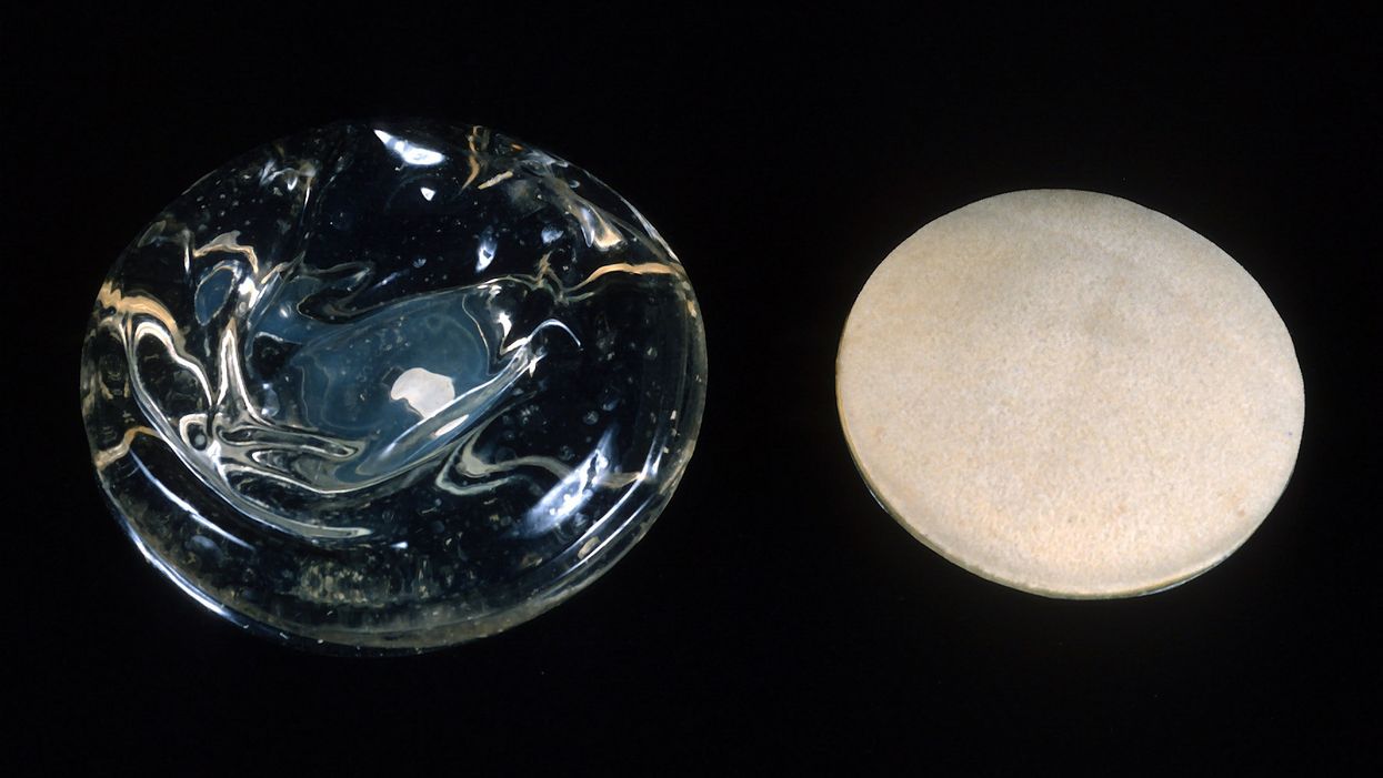 A woman is shot in the chest. Her breast implants likely save her life.