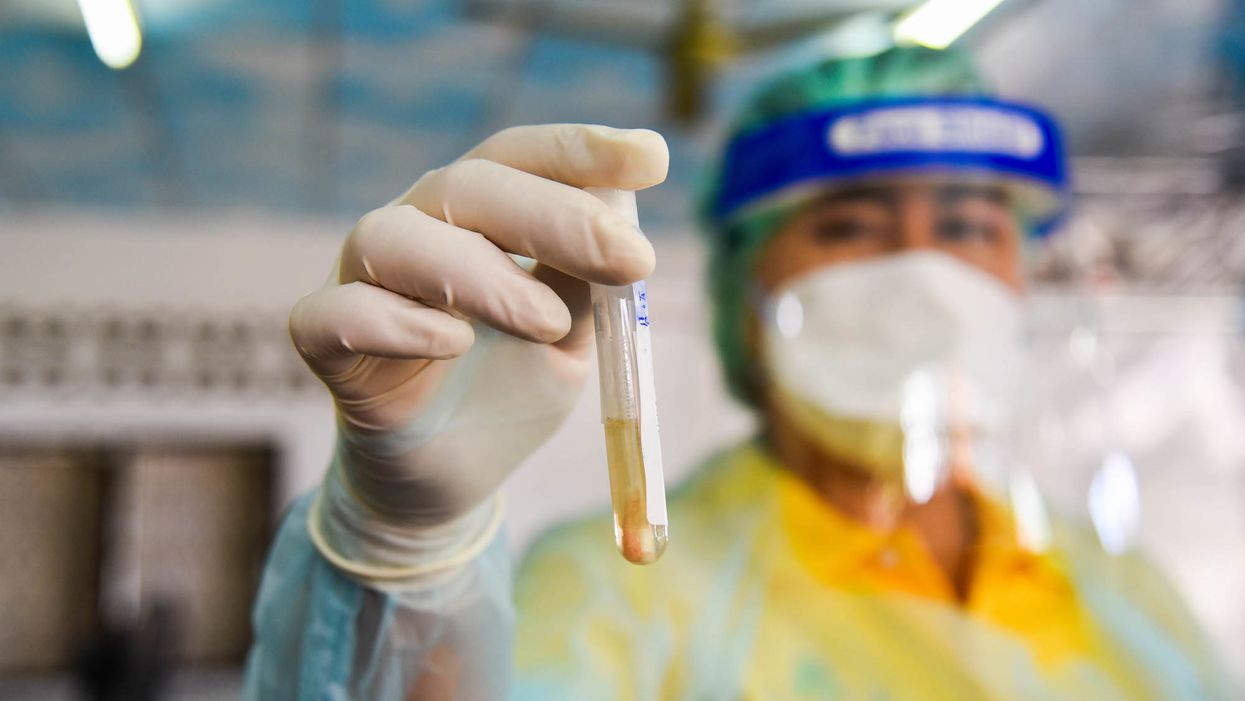 Israeli lab says they have reached a coronavirus antibody breakthrough, will begin mass production