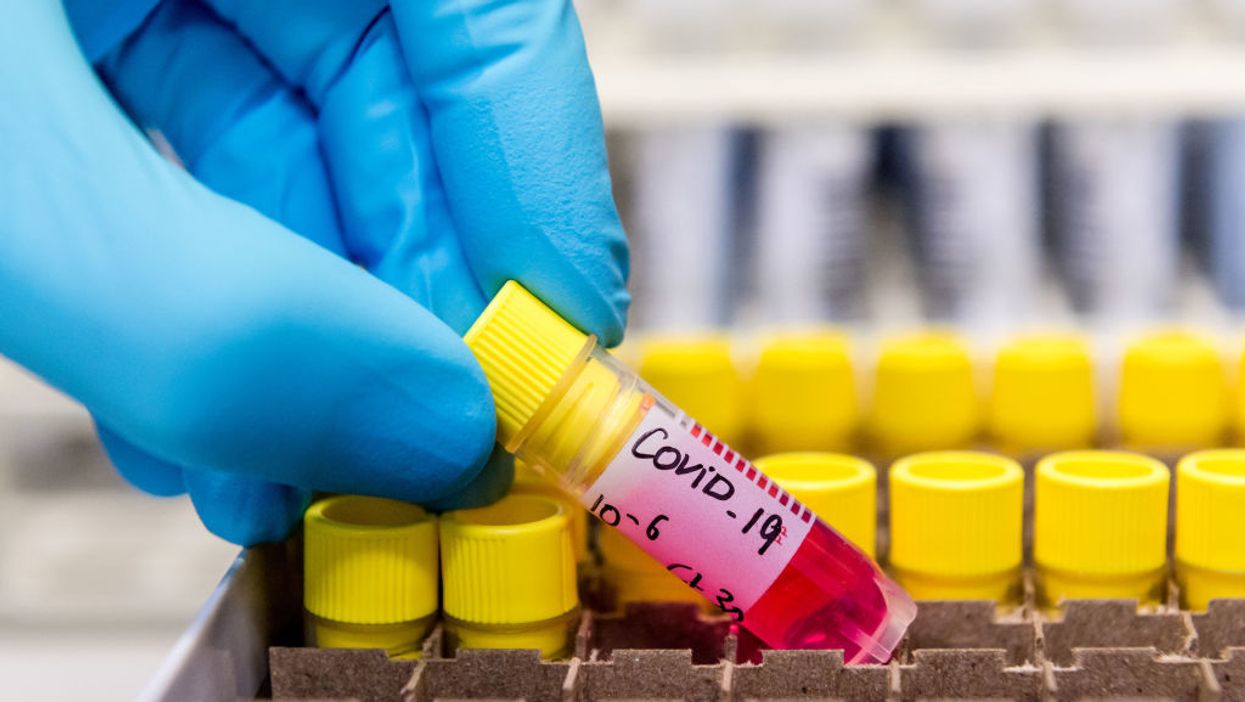 State's coronavirus death toll drops significantly after officials make major criteria change