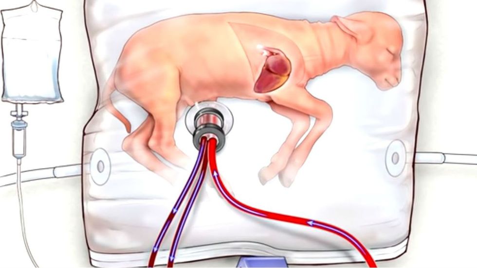 What do artificial wombs mean for humanity and our pre-born?