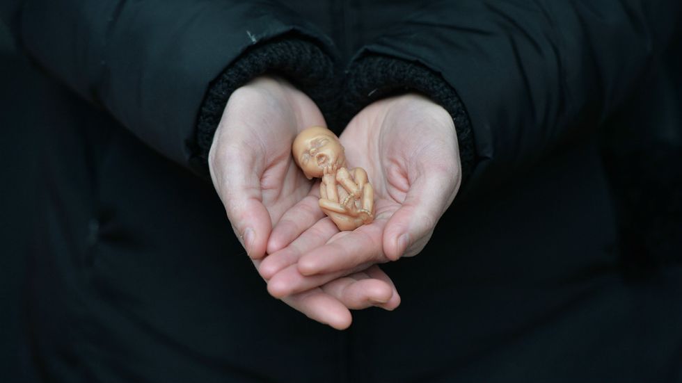 I wish President Trump was right, but not all Republicans believe life is sacred