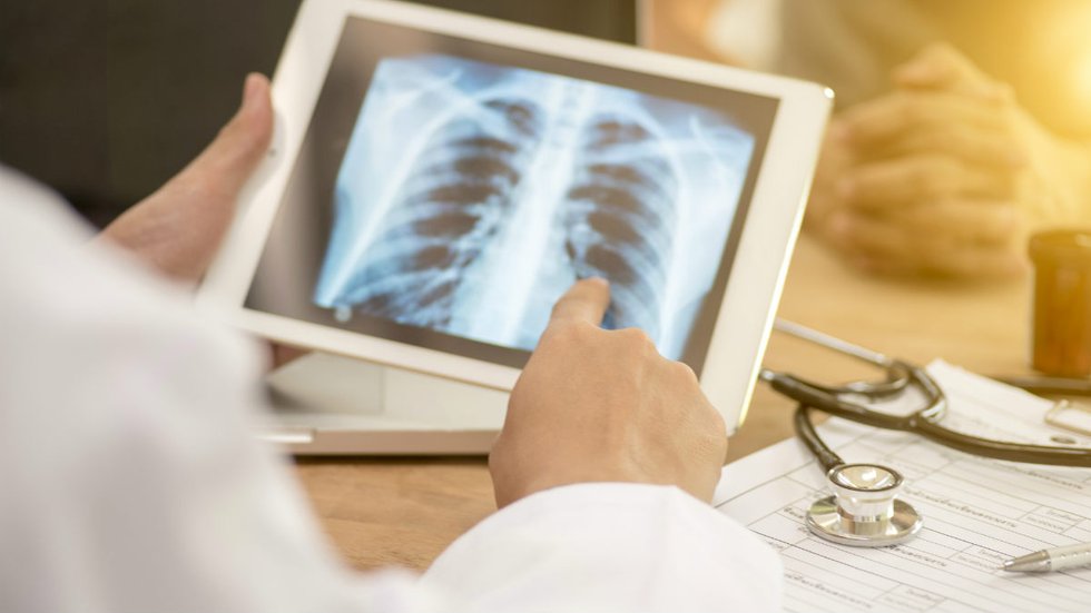 Border Patrol releasing thousands who were exposed to diseases like tuberculosis