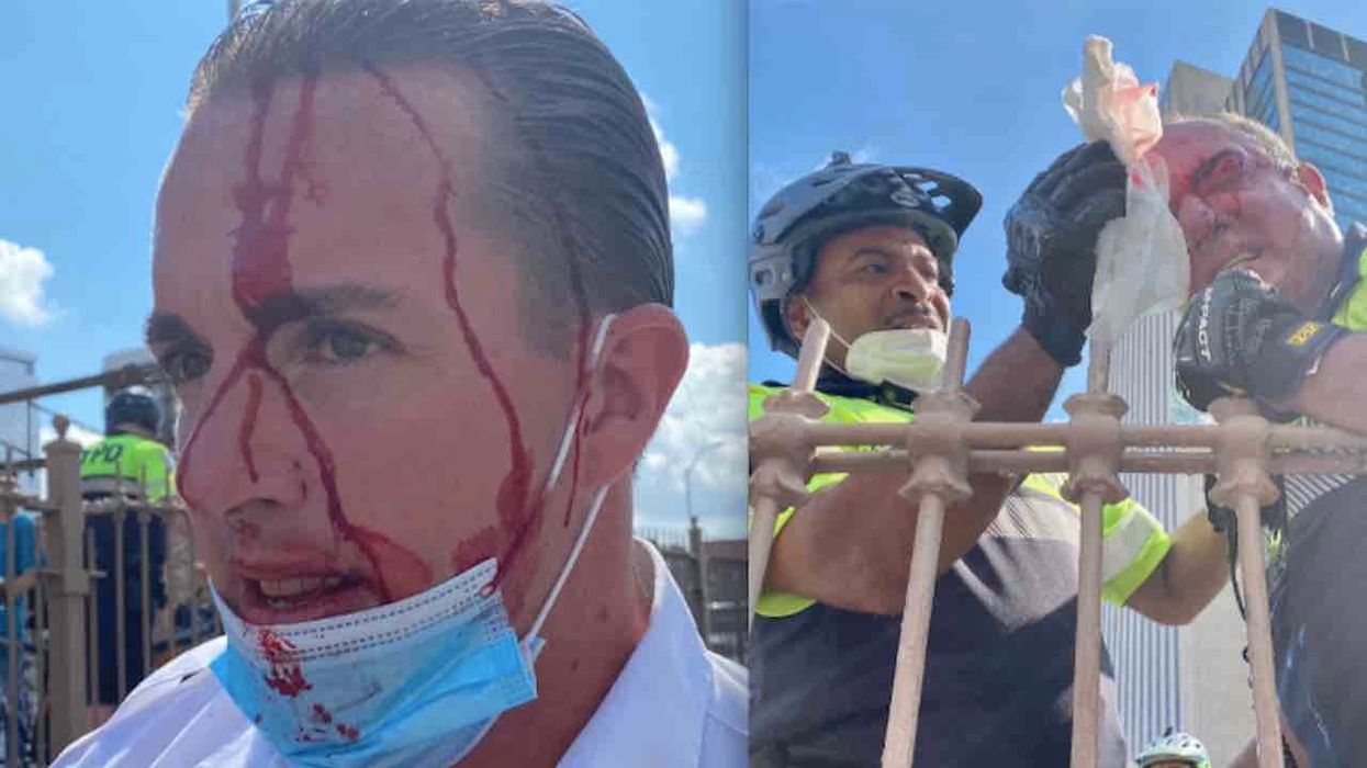 NYPD: Three cops 'violently attacked' by protesters on Brooklyn Bridge. One injured officer is chief of the department.