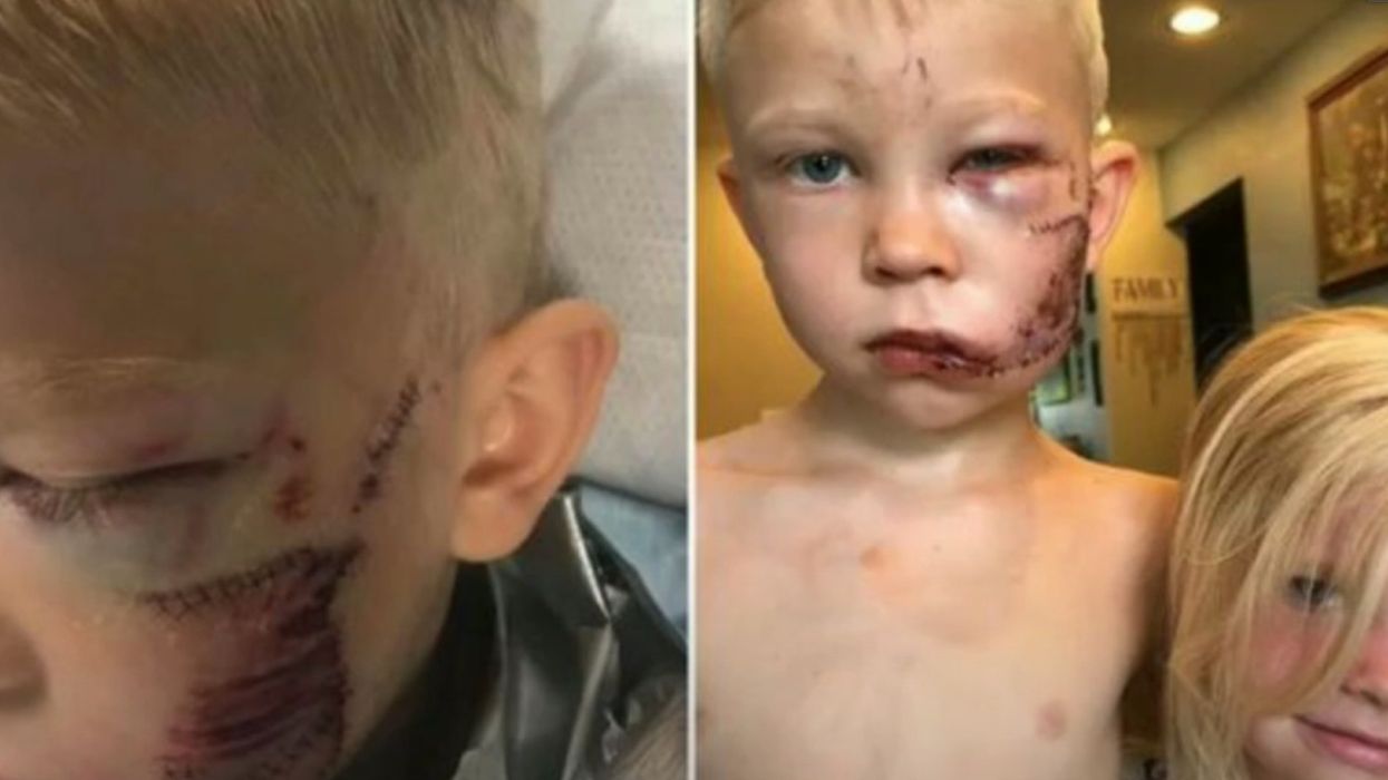 A 6-year-old boy is a hero after saving his little sister from a vicious dog attack: 'If someone had to die, I thought it should be me'