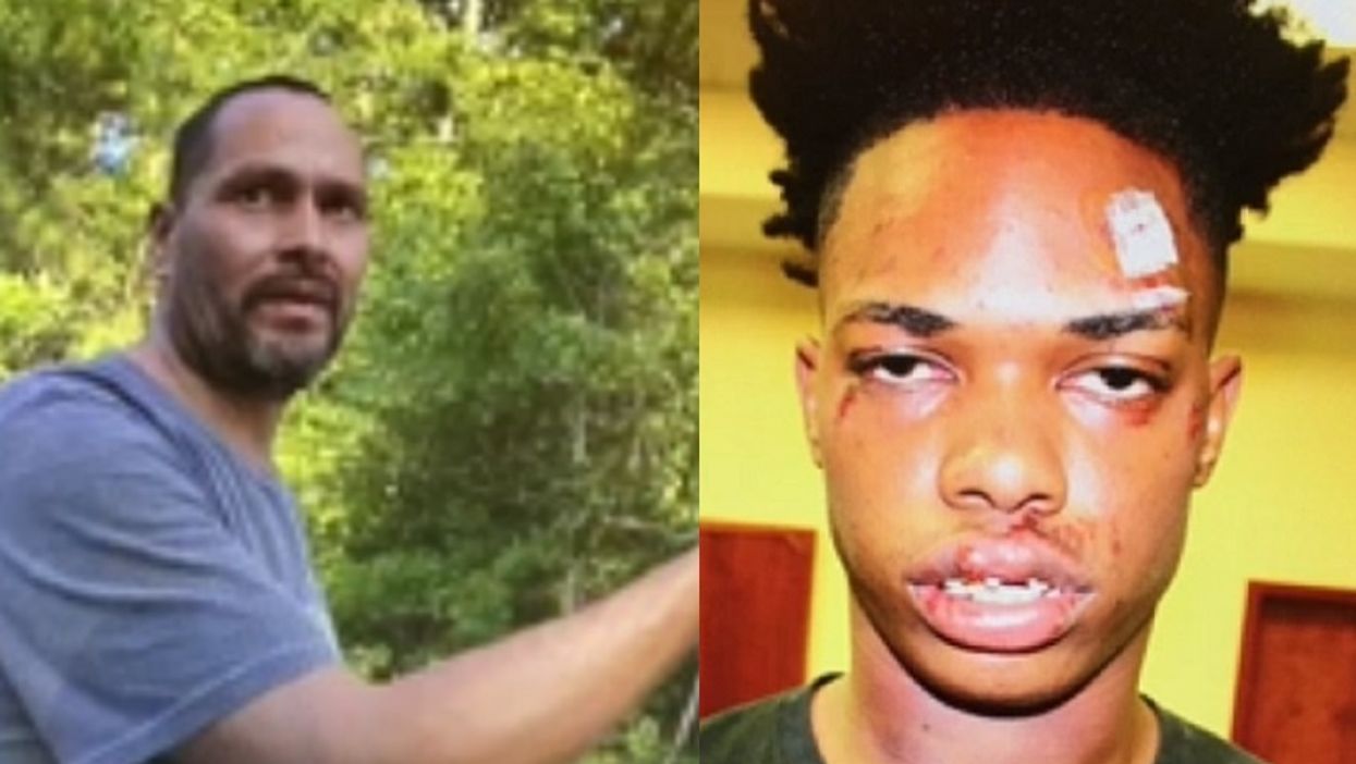 Dad arrested, charged after beating man, 20, he found in his 14-year-old daughter's room