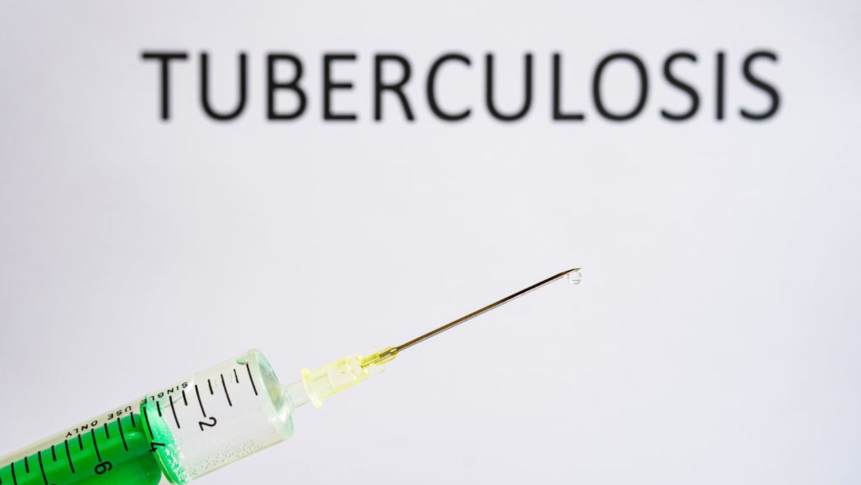 New York Times report: Coronavirus lockdowns may cause over 1 million deaths due to tuberculosis, other diseases