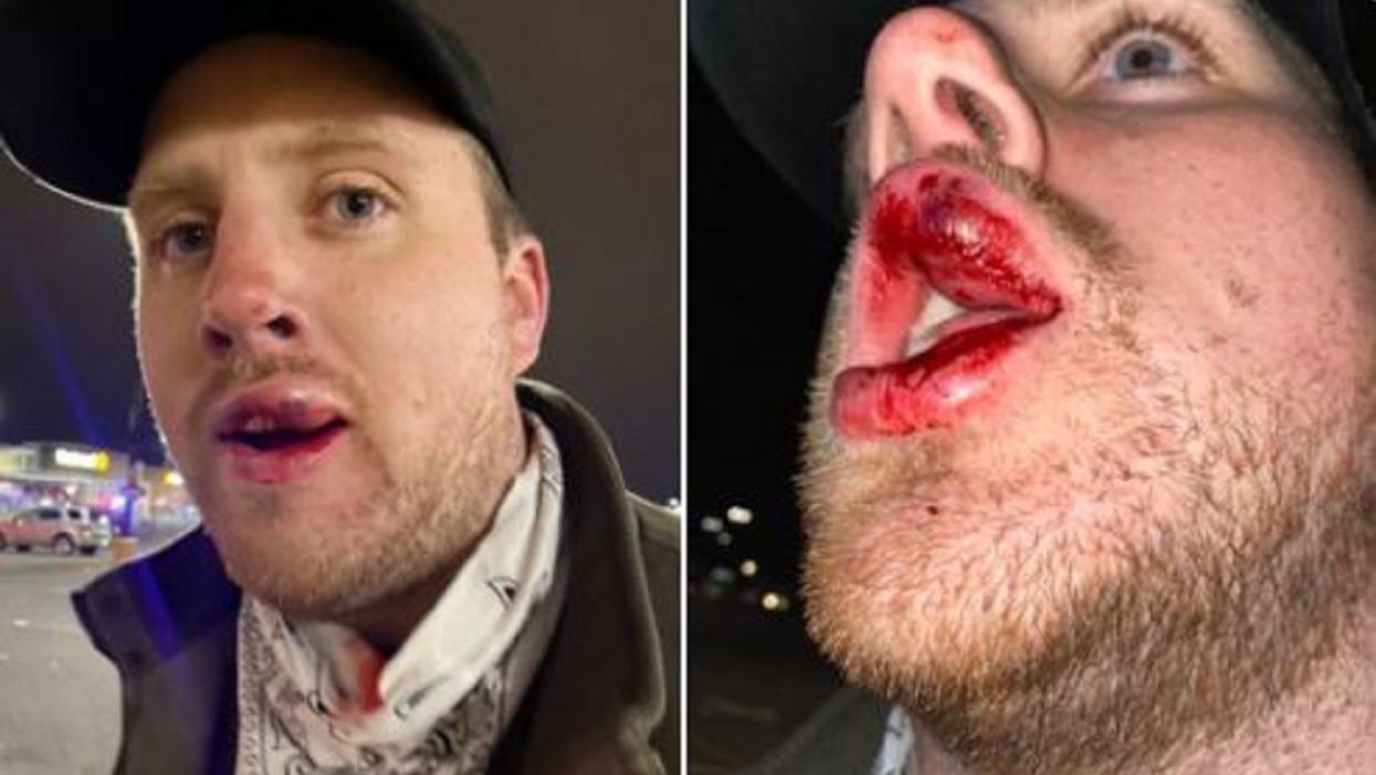 BlazeTV reporter beaten while filming the looting inside Philadelphia store