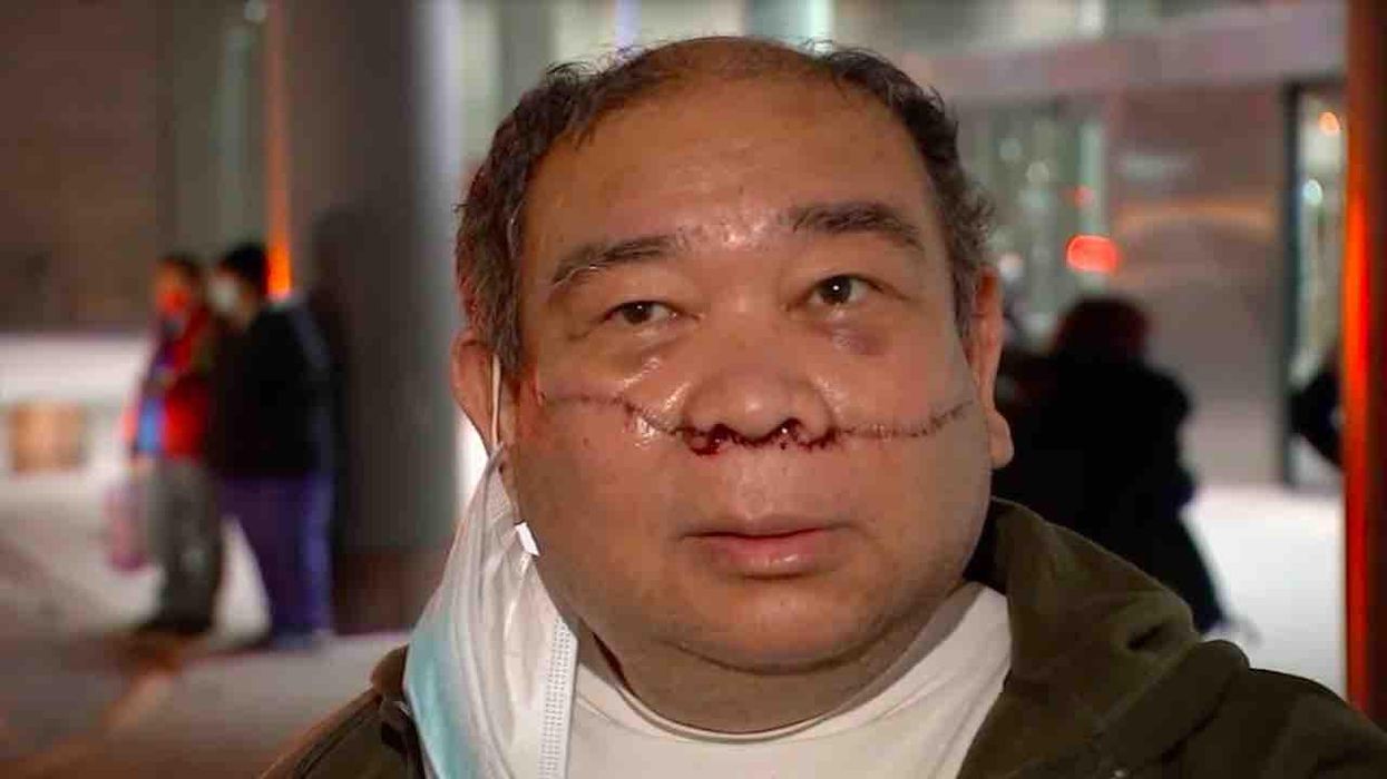 Asian man, 61, slashed across face on NYC subway train. Victim was riding to first of two jobs and asked suspect to stop kicking his backpack.