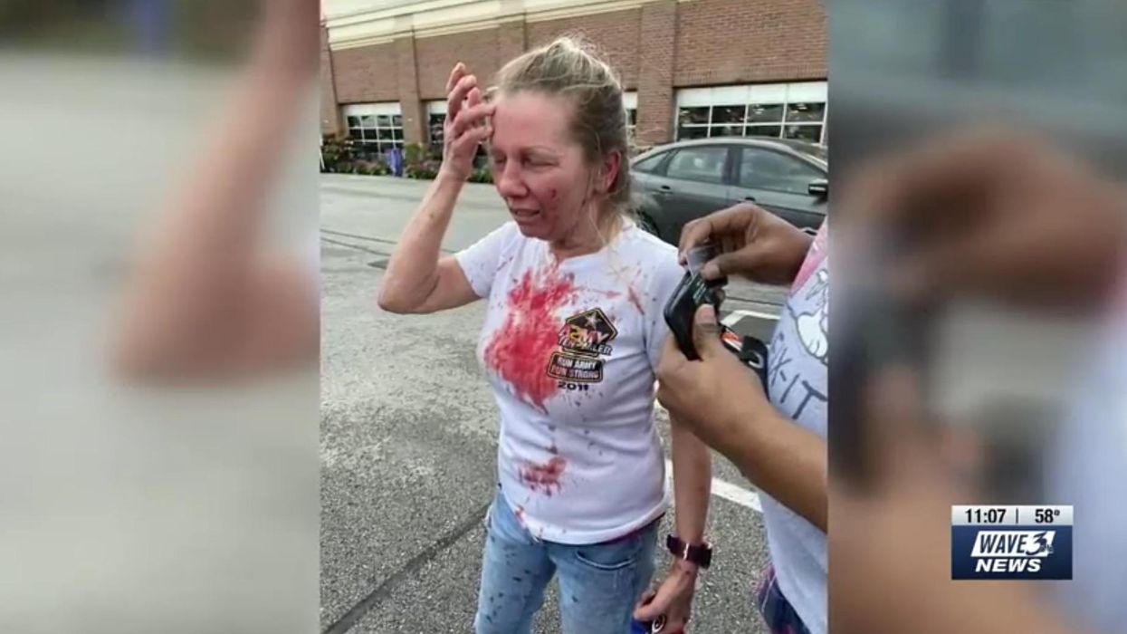 Disabled veteran says four black women brutally attacked her on Mother's Day: 'F*** you, you white b****'