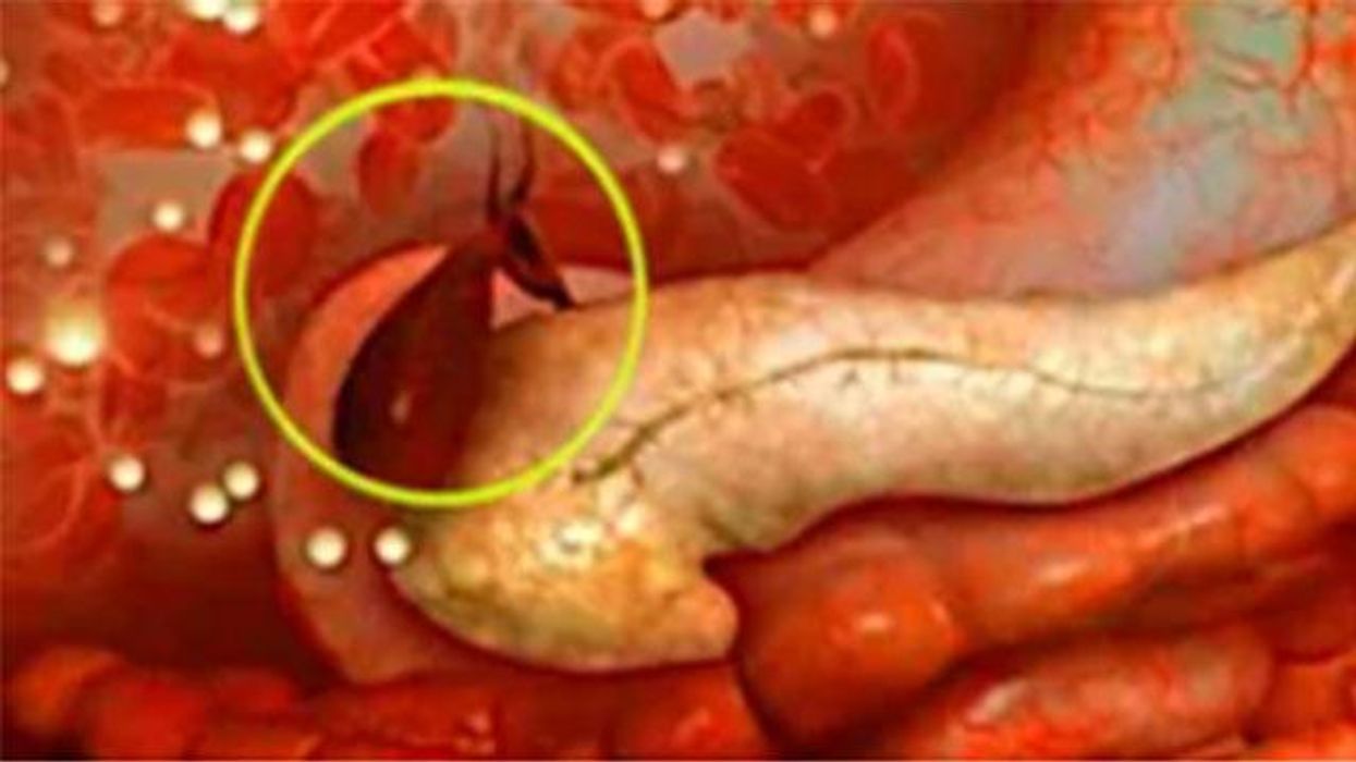 How to: Get rid of deep belly fat
