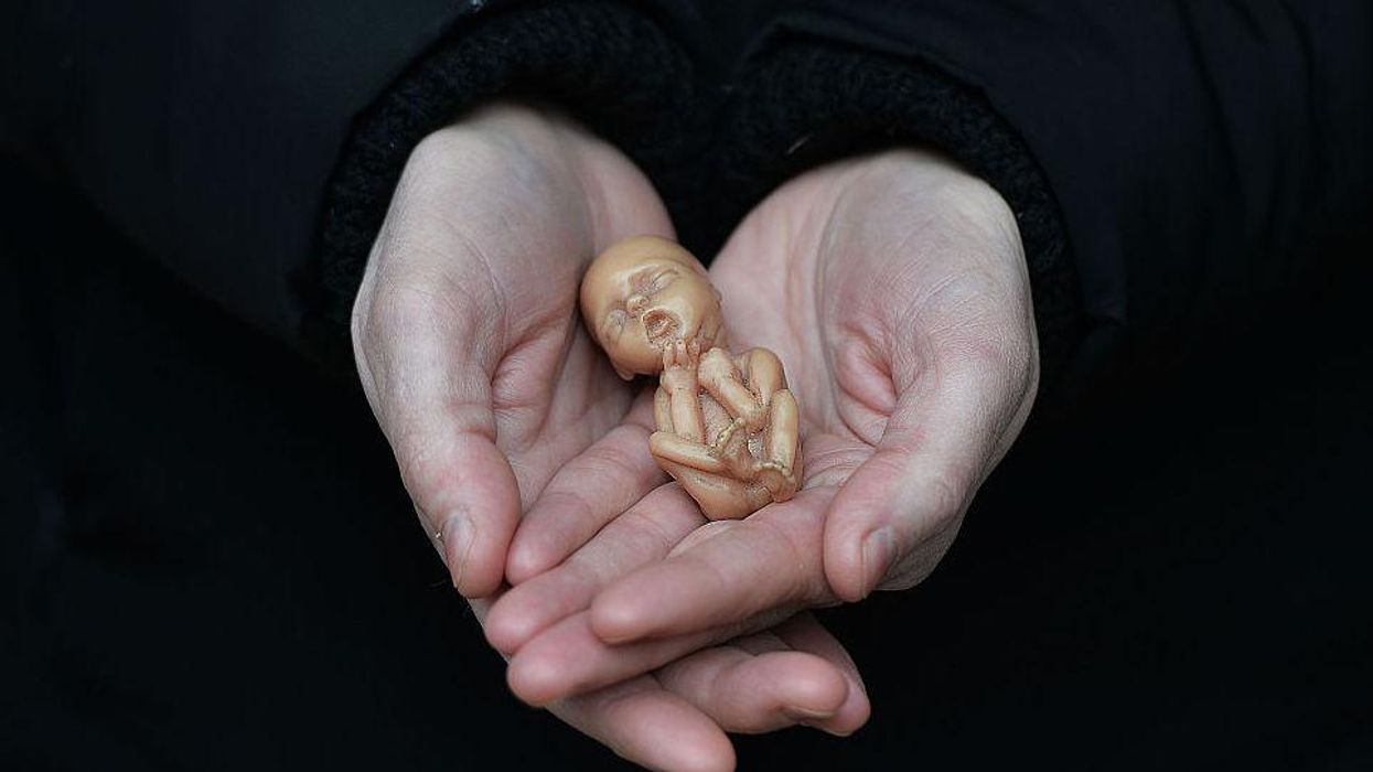 Texas doctor brags about violating new abortion law: 'I acted because I had a duty'