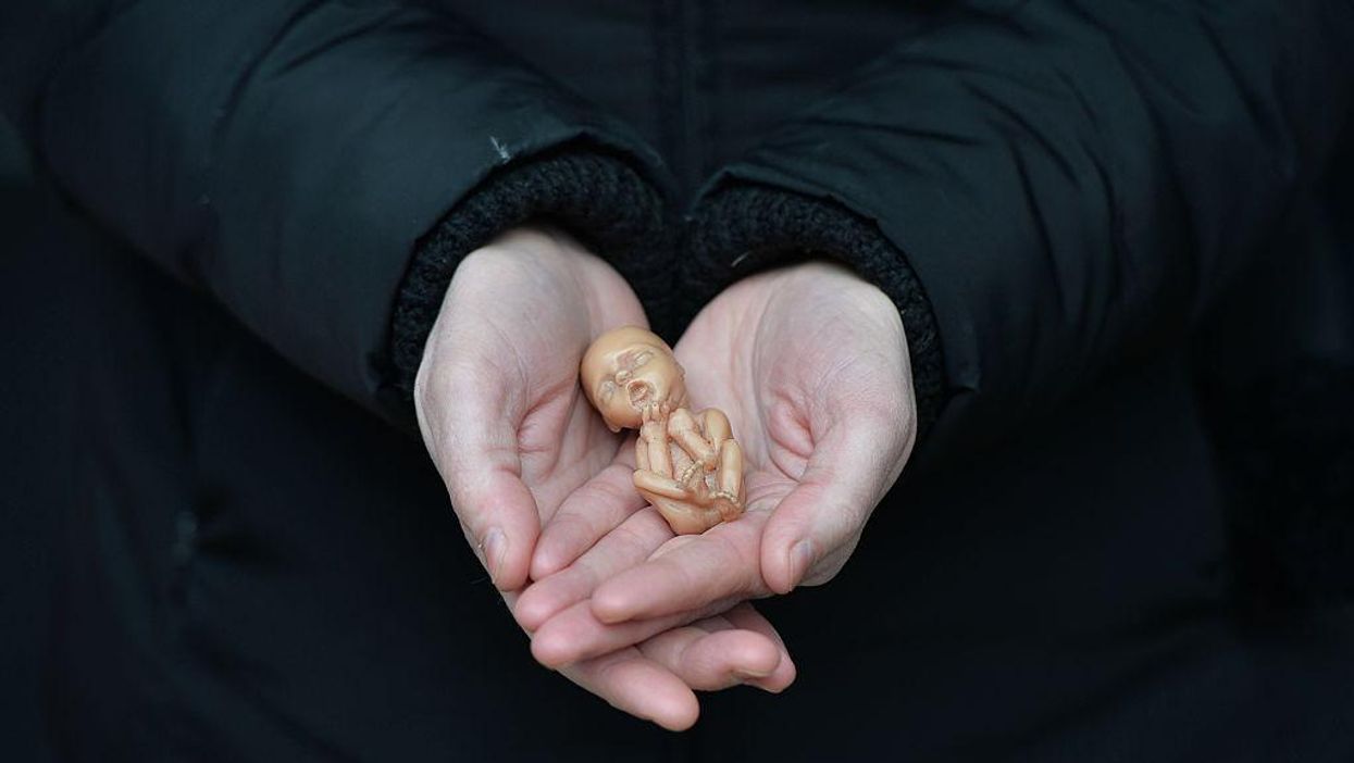 Florida state lawmaker files bill to prohibit abortions after an unborn child's heartbeat is detected, mirroring a Texas law