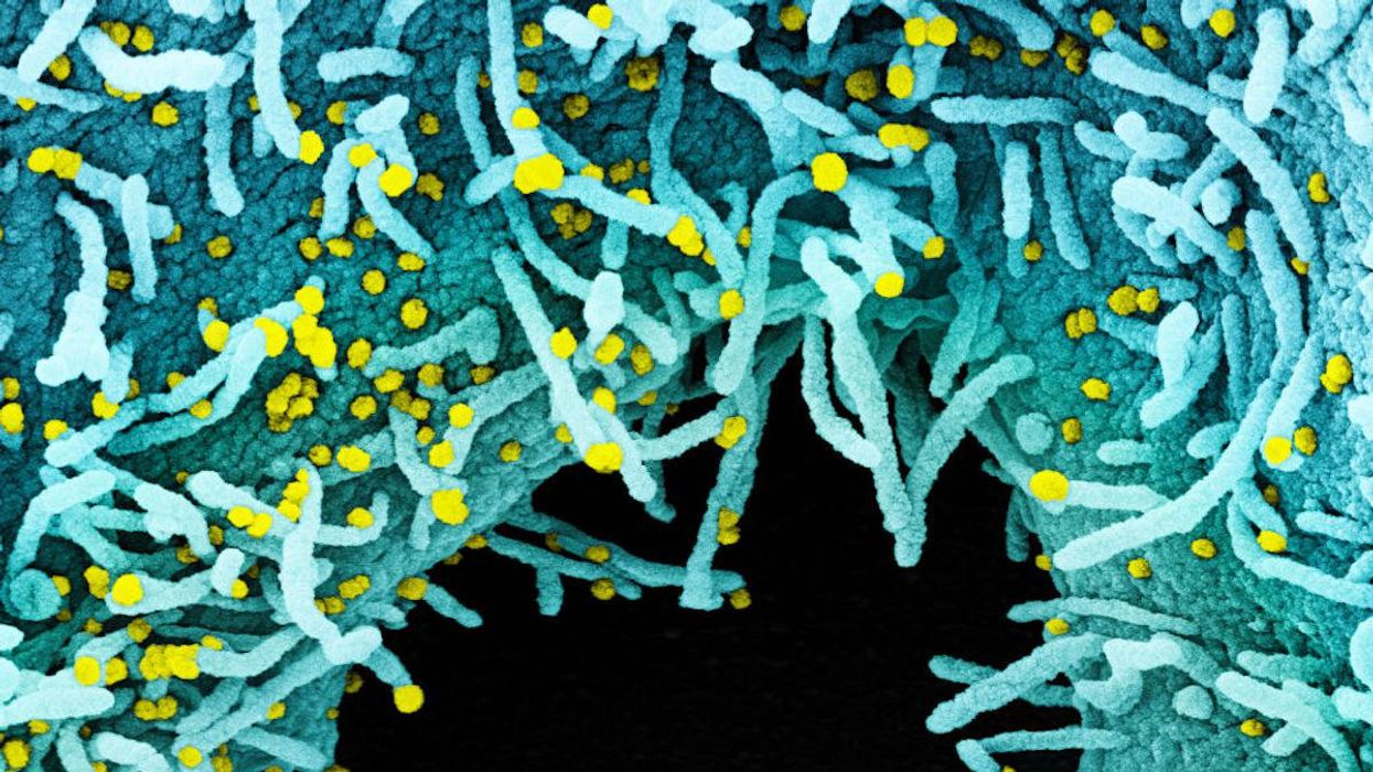 New COVID variant considered 'worse than' Delta is 'spreading rapidly' in South Africa and worrying health experts across the globe