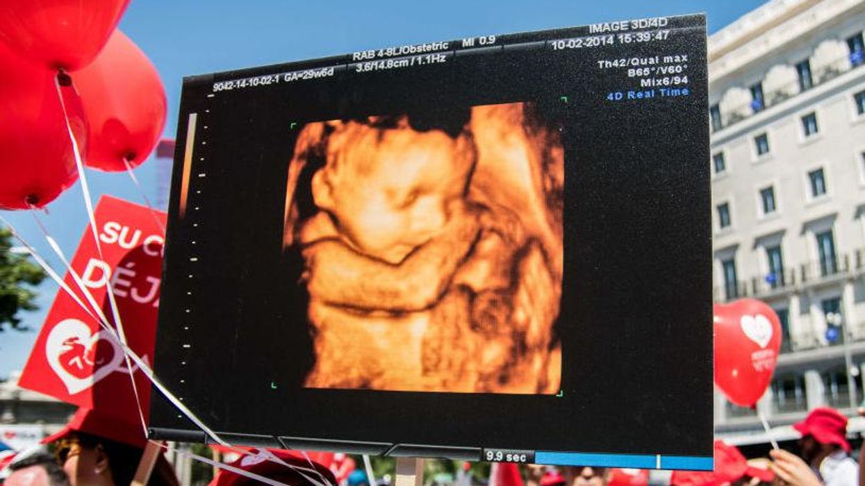 Democrat tries to dunk on pro-life advocates with new bill. But he back-pedals after undermining the progressive agenda.