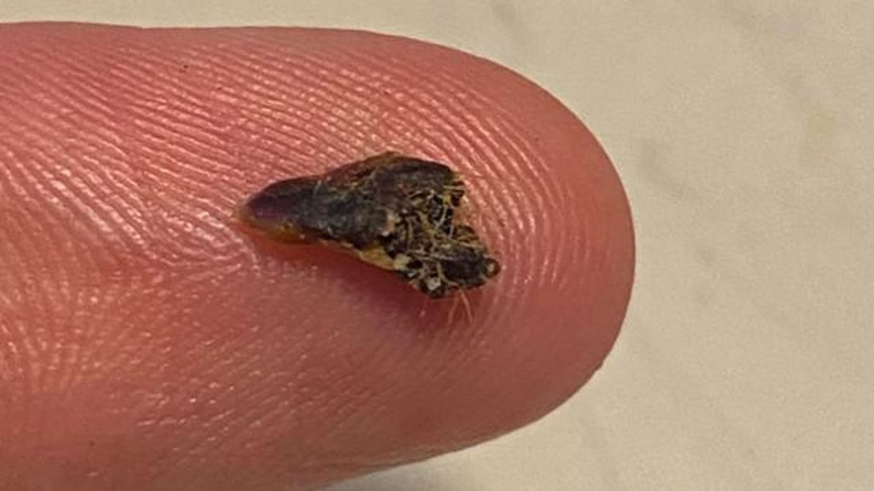 Simple trick completely removes earwax