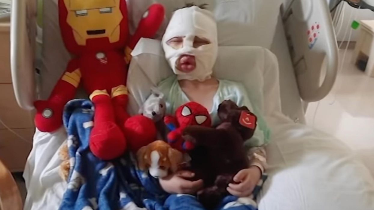 Donations pour in for 6-year-old boy who was severely burned in horrific bullying attack: 'Mommy, they lit me on fire!'