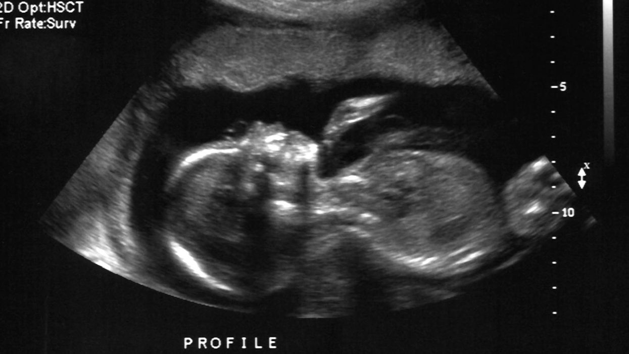 Viral tweet mocks miscarriages to make pro-abortion point. The wave of backlash comes swiftly.
