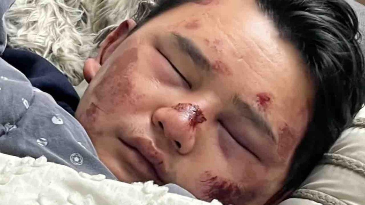 Asian man knocked unconscious from behind in Oakland, then beaten and robbed, believes he was targeted because of his race: 'This happens all the time'