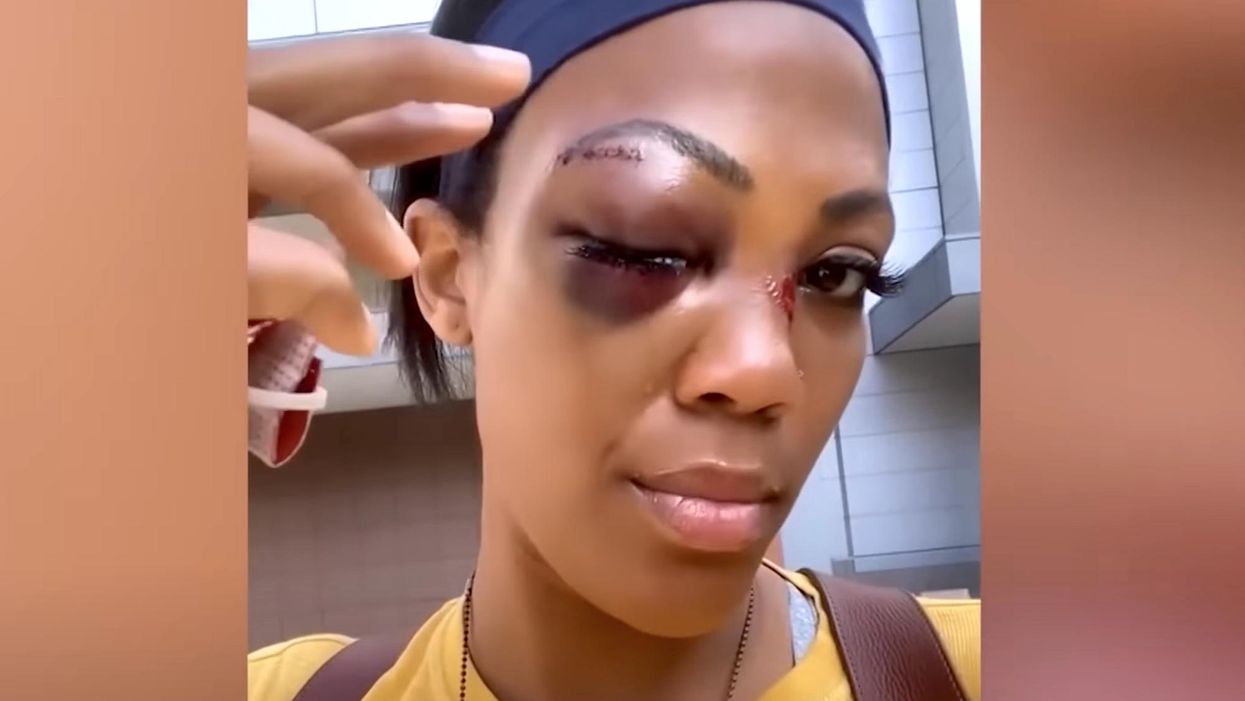 Olympic medalist says a homeless person attacked her with a metal pipe outside a Los Angeles restaurant