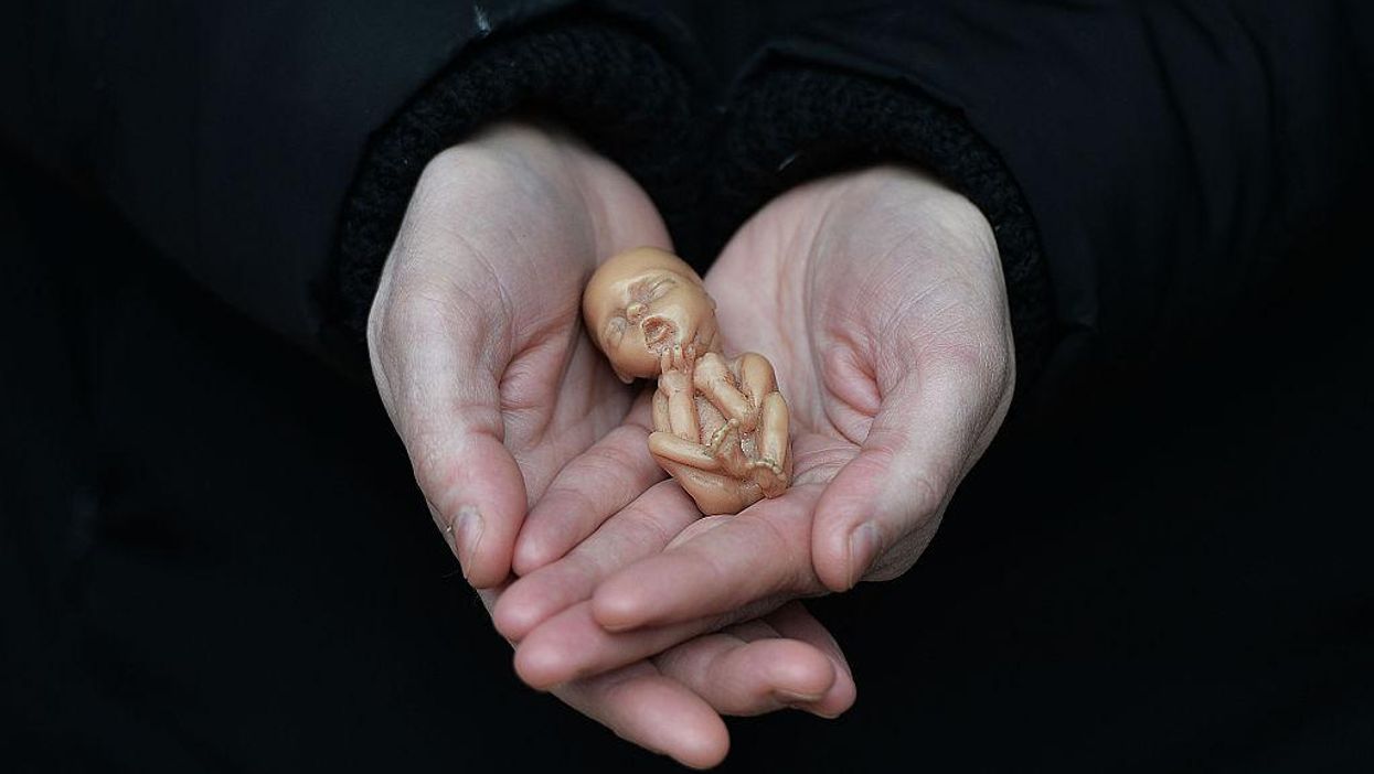 Leftist writer Jill Filipovic says 'Unborn child' is an 'Orwellian' phrase meant 'to short-circuit our ability to think and speak about human existence and life with necessary complexity'