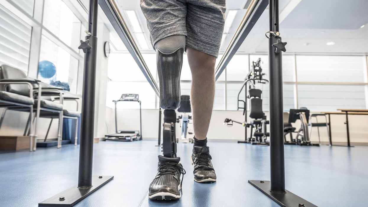 Divers retrieve man's prosthetic leg, valued at $80K, from Michigan lake