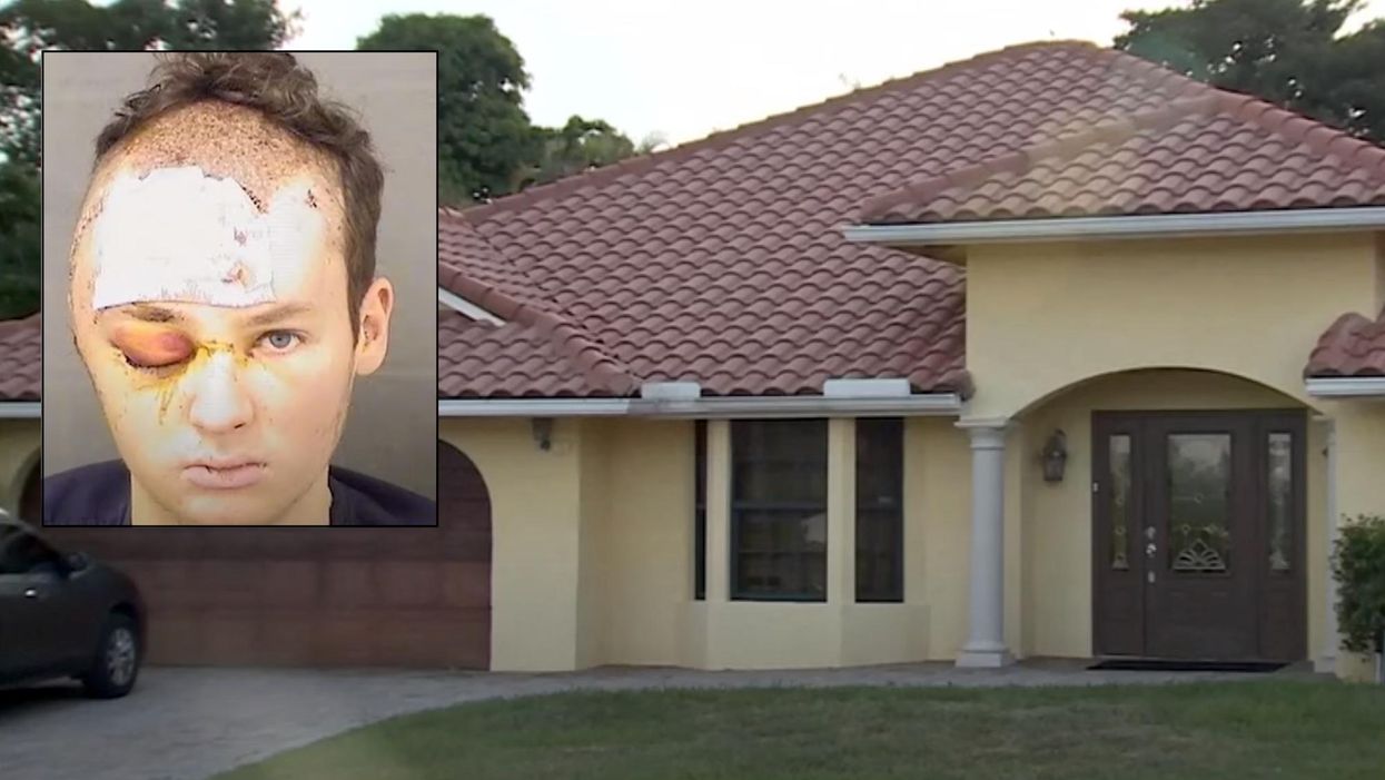 Man allegedly raped and brutalized his social worker for 15 hours until police saved her by shooting him in the head