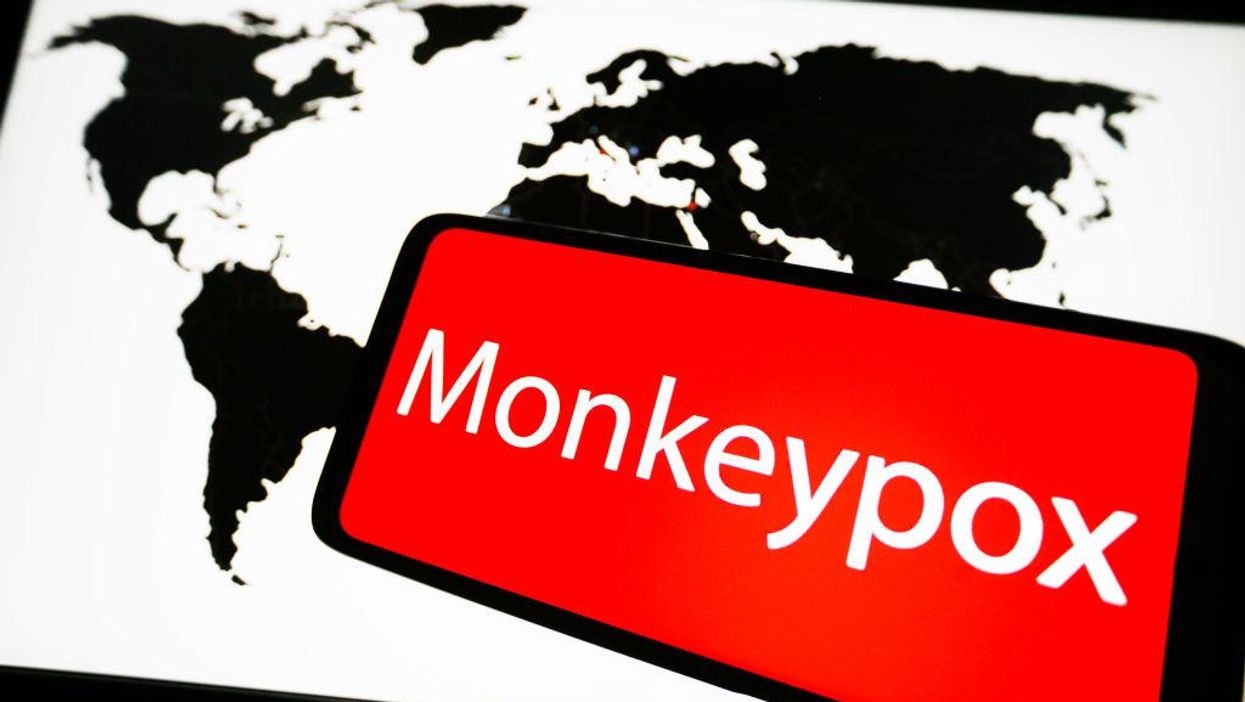 Science reporter apologizes for 'inadvertently causing entire global monkeypox outbreak' with one HILARIOUS typo
