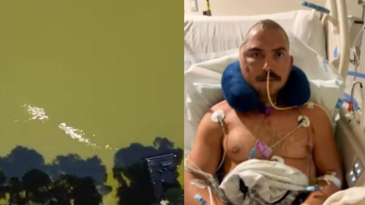 'A walking miracle': Drone captures moment Florida man is mauled by a large alligator. He fought off attack but had his skull crushed.