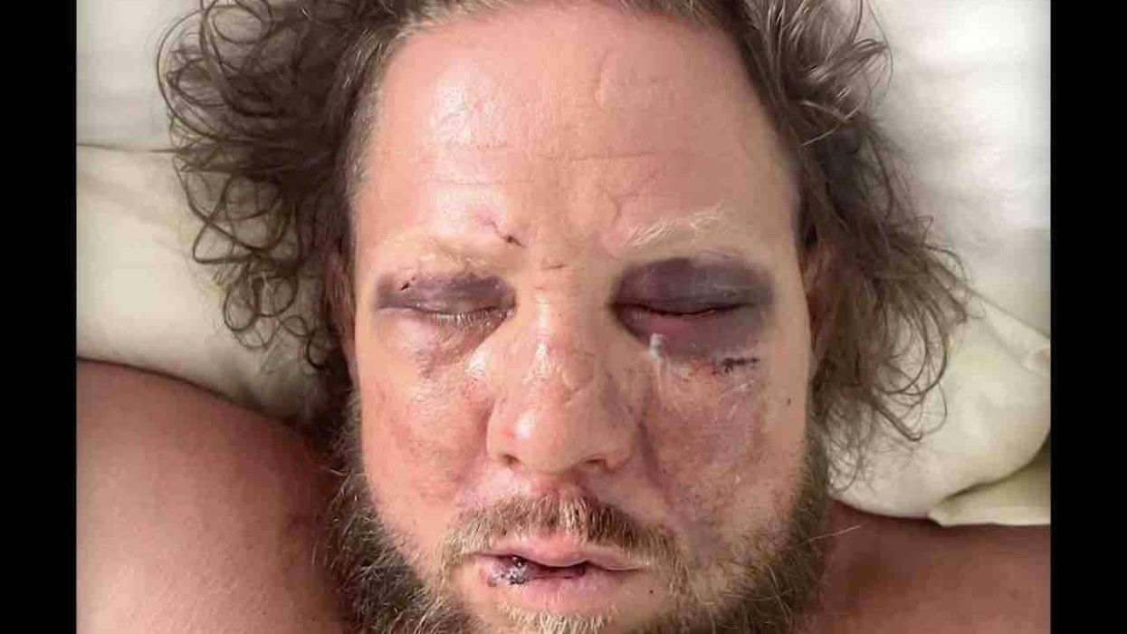 'Scumbags': Man brutally beaten, stomped on at wedding reception by father, son who have extensive violent criminal histories, authorities say