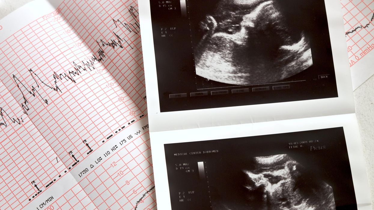 Planned Parenthood changes website to seemingly deny that unborn babies have a heartbeat at 6 weeks: 'It sounds like a heartbeat ..., but ...'