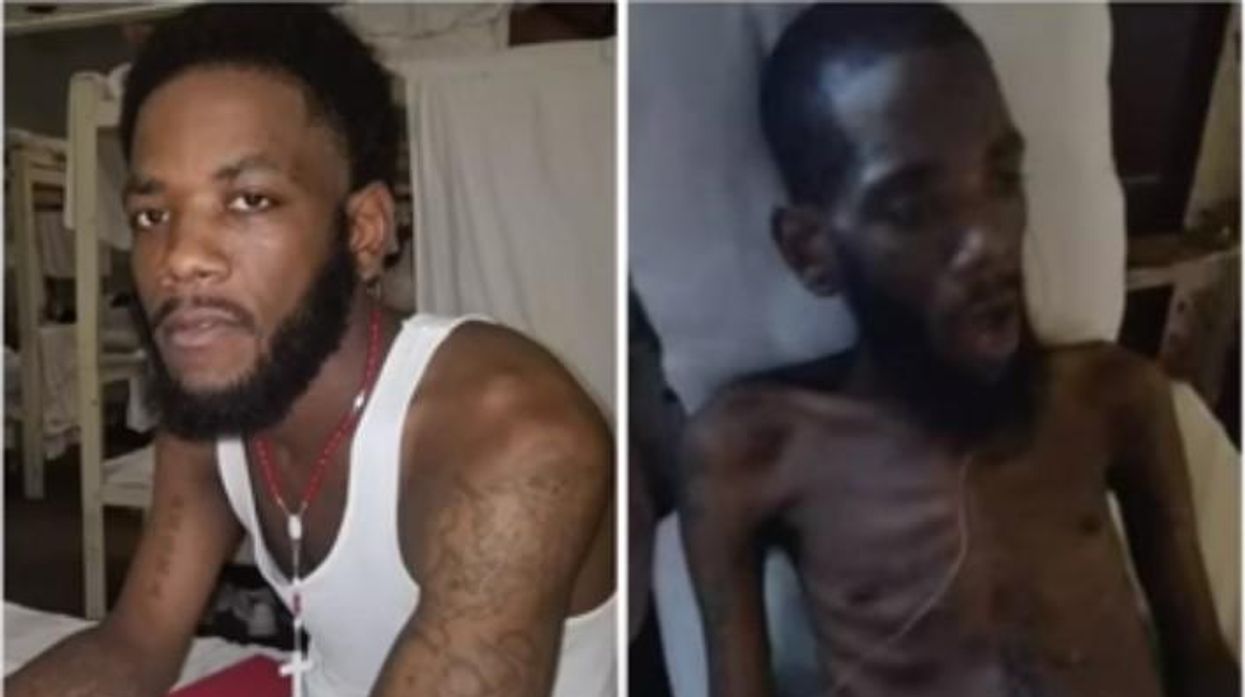 Frightening photos of Alabama prisoner go viral, but state DOC claims he won't cooperate with medical advice