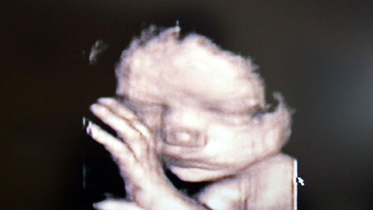 US Supreme Court declines to take up case concerning the personhood of unborn babies