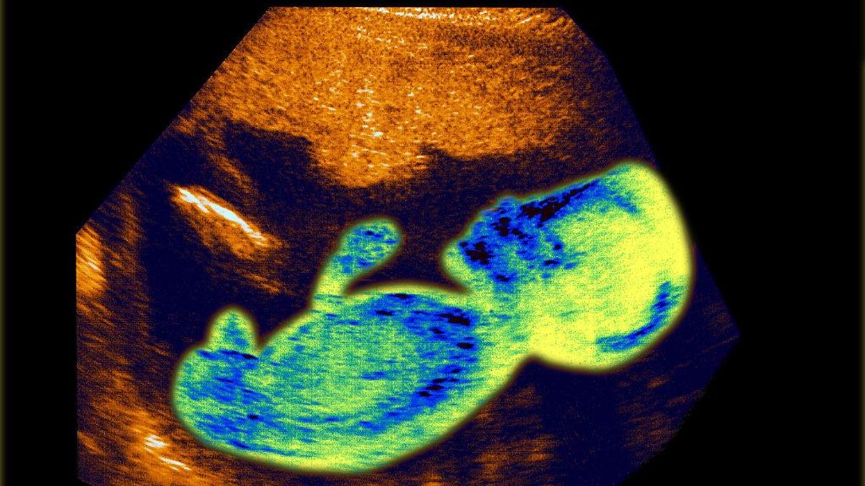 NPR airs HORRIFIC recording of woman getting abortion