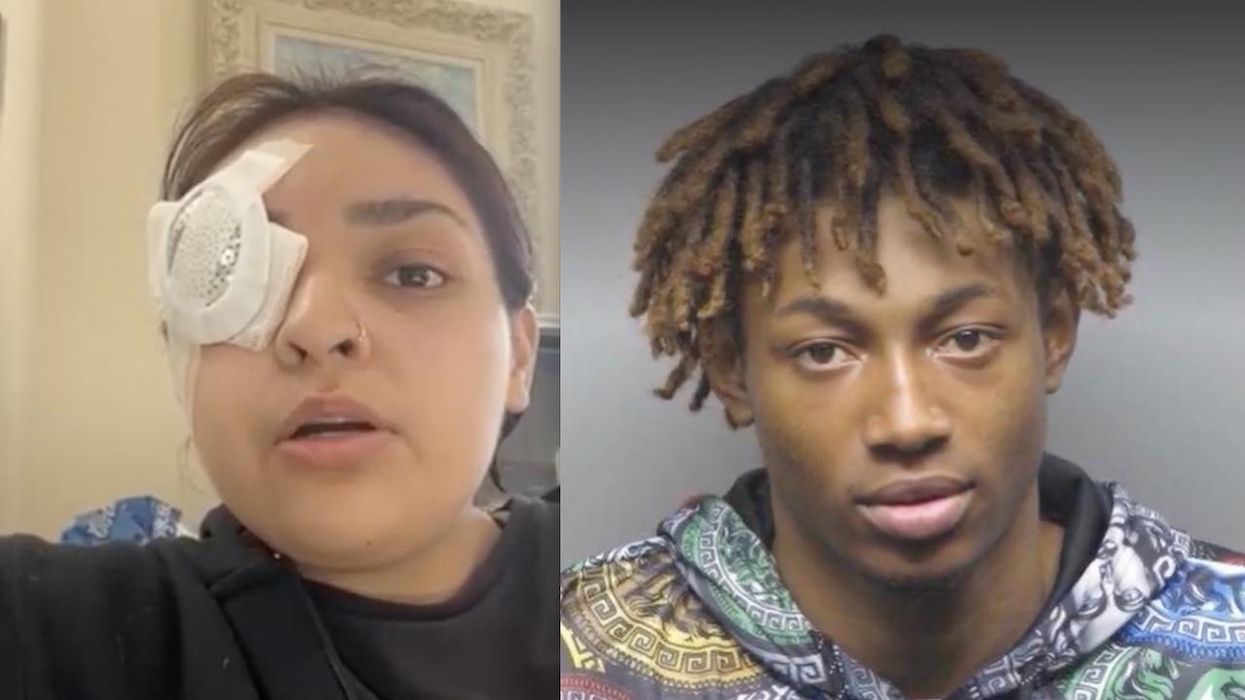 Arrest made in case of woman, 19, who lost eye after being punched in head while standing up for special-needs boy. She told her attacker to stop bullying him.