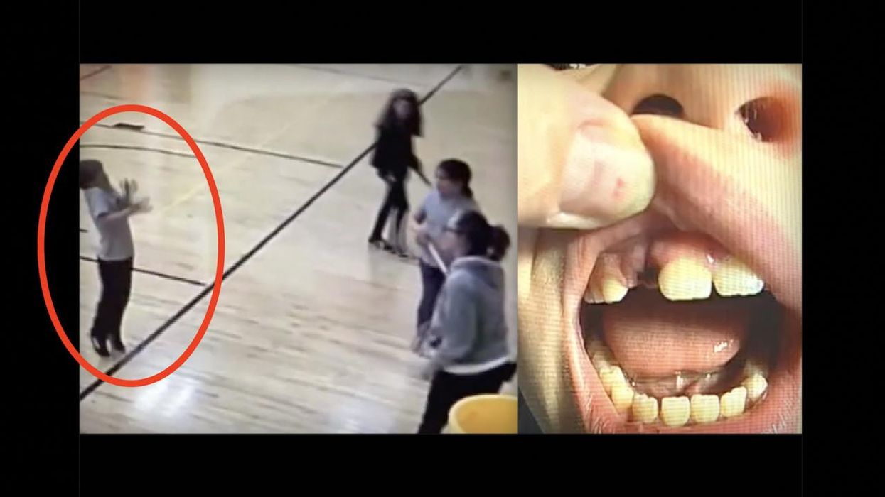 Former teacher who threw hockey stick at 2nd grader — after which boy suffered knocked-out tooth — pleads guilty to assault: 'Like she was trying to hurt him'