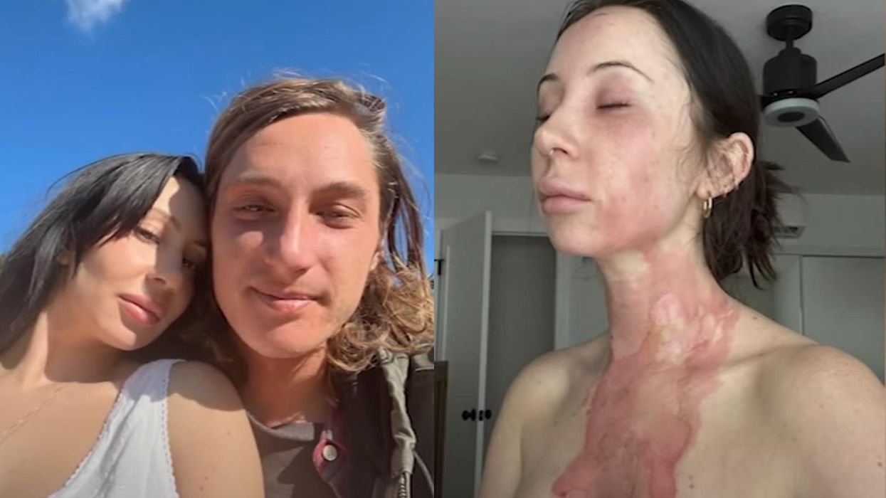 Couple moves from Los Angeles after woman suffered third-degree burns in boiling water attack by knife-wielding intruder