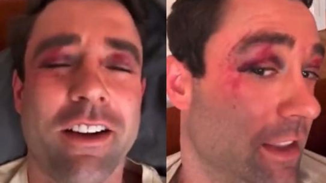 Fox News weatherman attacked by group of teens on NYC subway after he defended elderly man; police let suspects go free