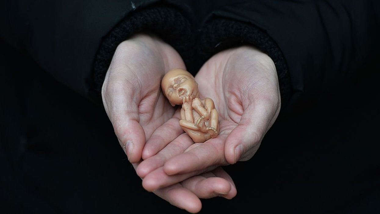 6-week abortion ban proposed in Florida