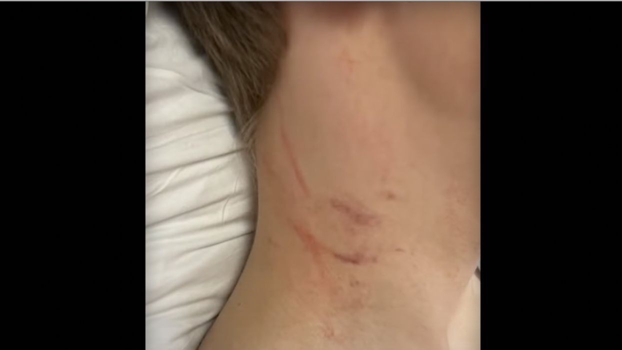 Female school bus driver accused of choking middle school boy who has special needs: 'Put her hands around his neck and started squeezing and scratching'