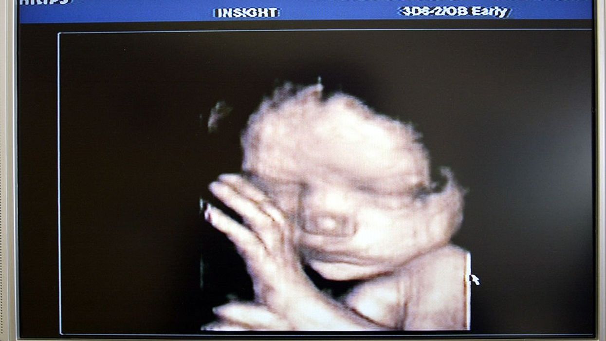 Judge temporarily blocks South Carolina's abortion ban