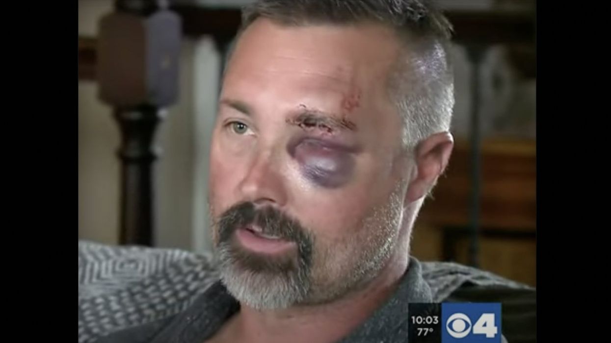 'I thought he was going to die': Man savagely stomped by group of males in front of his wife, needs stitches to reattach eyelid