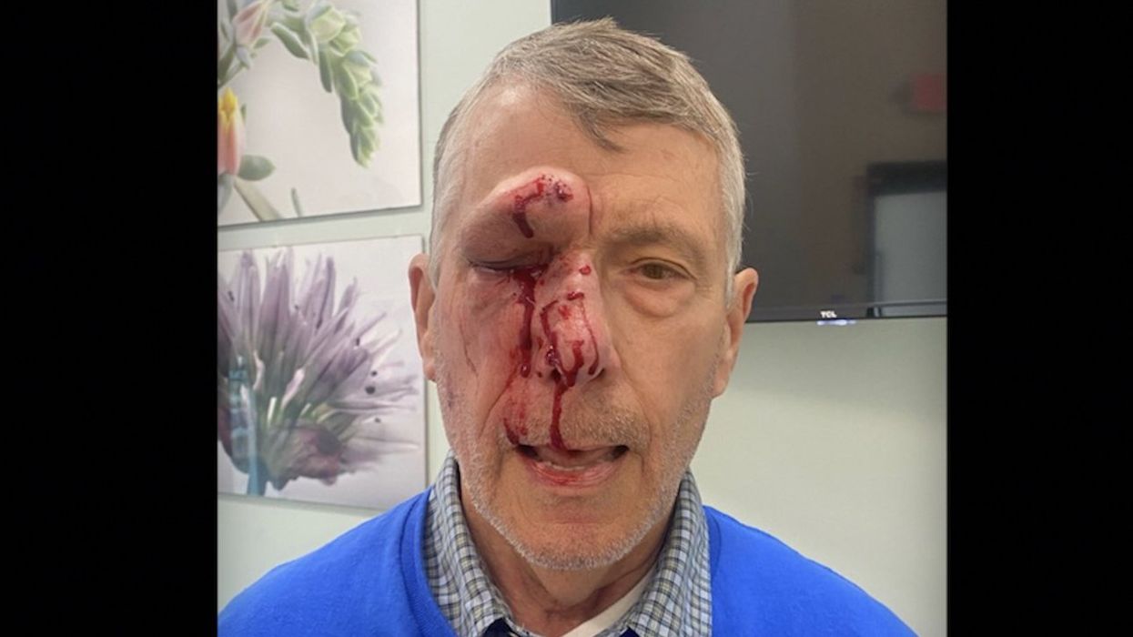 Cops release surveillance images of man believed to be in his 20s who brutally punched, kicked face of elderly pro-lifer outside Planned Parenthood
