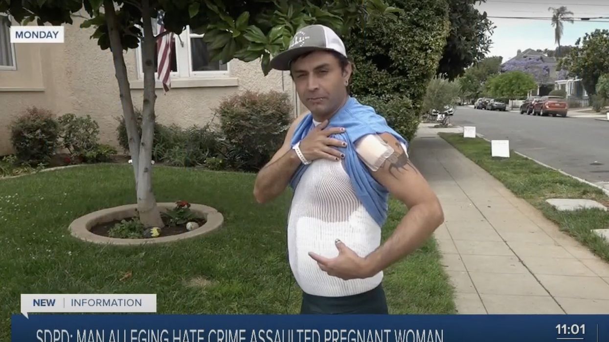 Gay man claimed he was set on fire in hate-crime attack; but cops say video shows him beating up pregnant woman — who fought back with flame